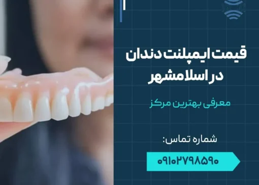قیمت ایمپلنت دندان در اسلامشهر - محله یار