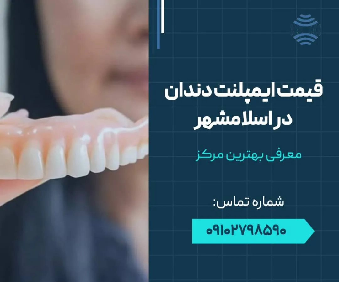 قیمت ایمپلنت دندان در اسلامشهر - محله یار