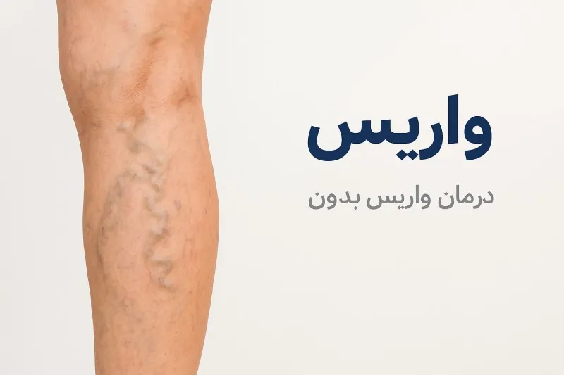 دکتر متخصص واریس در اسلامشهر 2 دکتر متخصص واریس در اسلامشهر- محله یار