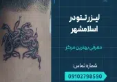 لیزر تاتو در اسلامشهر - محله یار