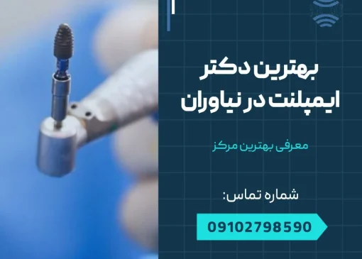 بهترین دکتر ایمپلنت در نیاوران- محله یار
