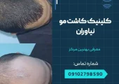 کلینیک کاشت مو نیاوران- محله یار