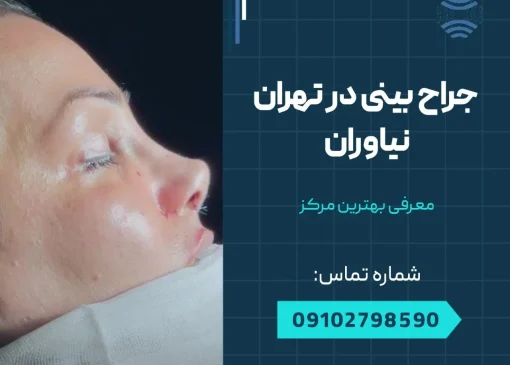 جراحی بینی در تهران نیاوران- محله یار