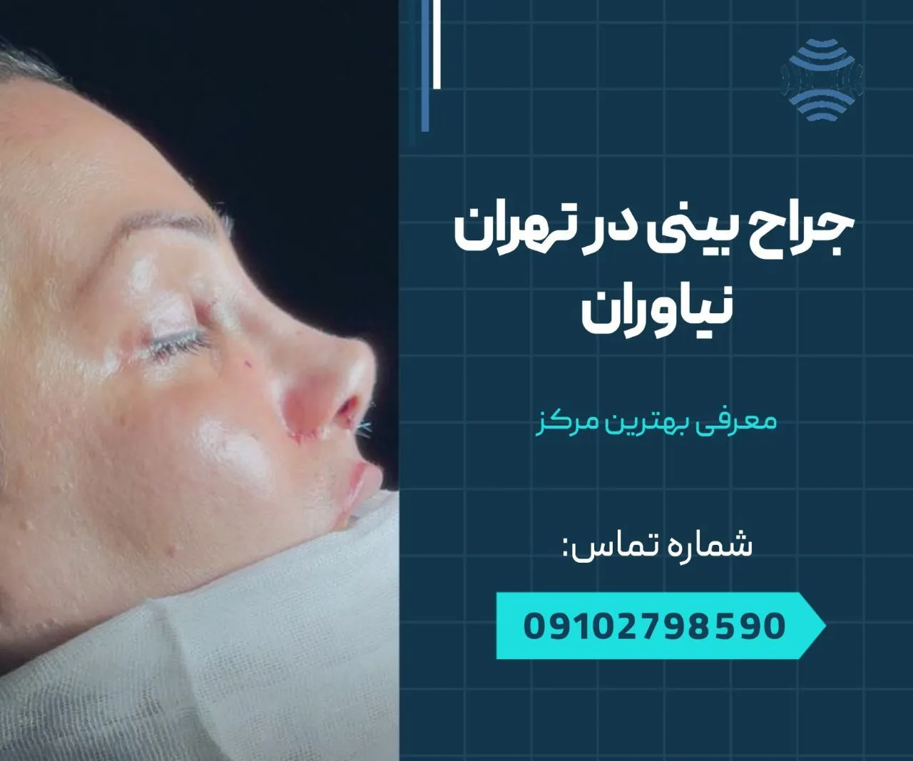 جراح بینی در نیاوران 1 جراحی بینی در تهران نیاوران- محله یار