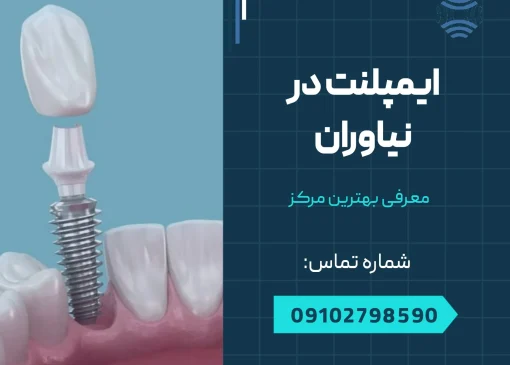 ایمپلنت در نیاوران - محله یار