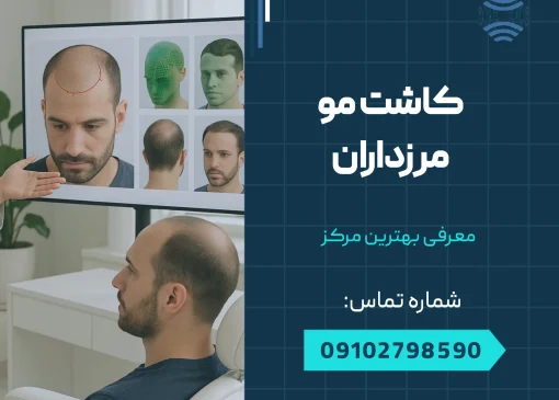 کاشت مو مرزداران _ محله یار
