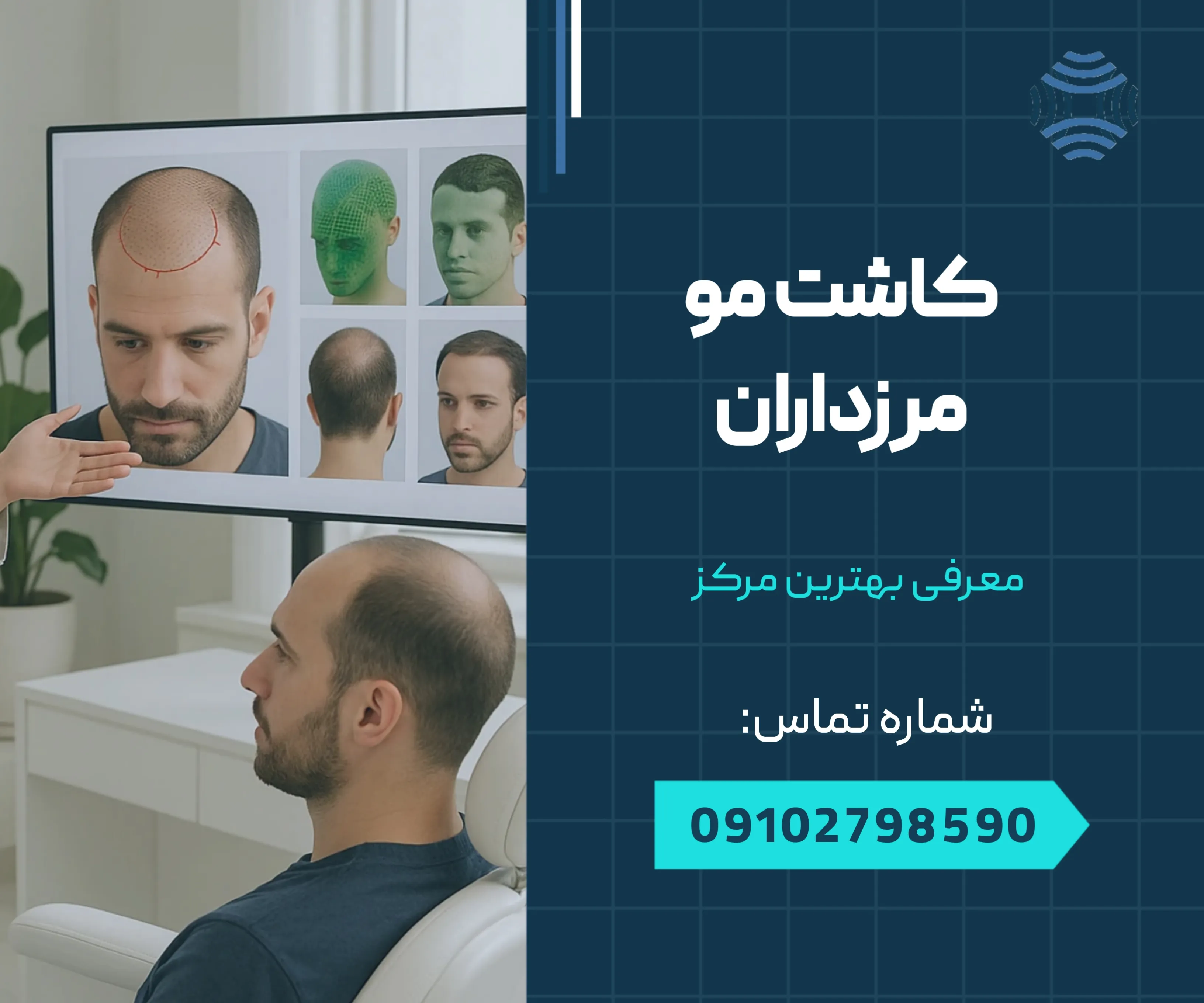 کاشت مو مرزداران 1 کاشت مو مرزداران _ محله یار