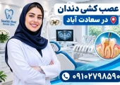 عصب کشی دندان در سعادت آباد | محله یار